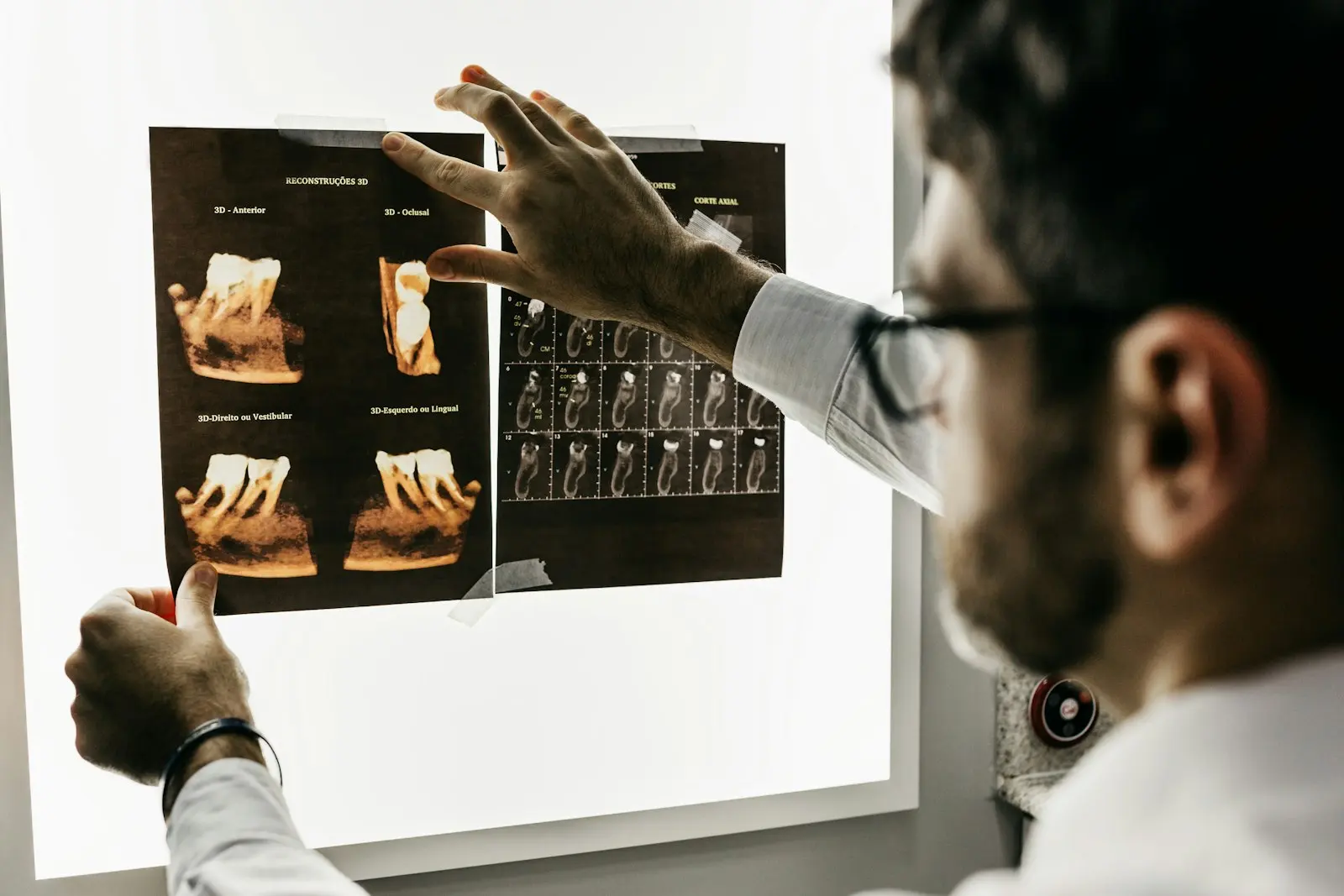 Dentista analisando radiografias em negatoscópio